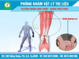 Đau nhức cơ bắp khi tập luyện & chơi thể thao