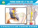 Viêm cột sống dính khớp - Căn bệnh nguy hiểm