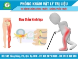 Nguyên nhân đau thần kinh tọa và cách điều trị