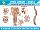 Thoái hóa khớp ngày càng trẻ hóa