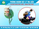 Các dấu hiệu của bệnh trượt đốt sống