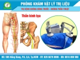 Đau thần kinh tọa, căn bệnh có thể gặp ở mọi lứa tuổi